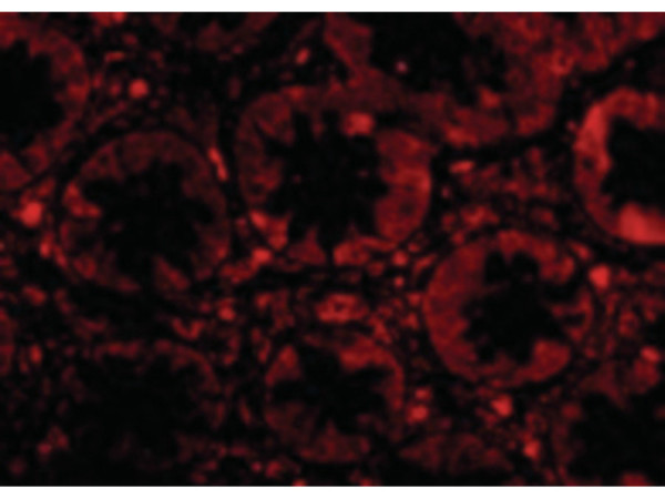 Anti-TEM1
