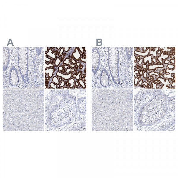 Anti-CSN3