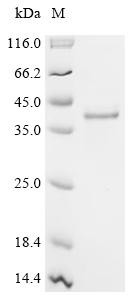 Mammaglobin-B (SCGB2A1), recombinant human