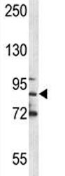 Anti-MPO / Myeloperoxidase