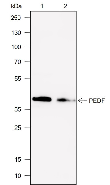 Anti-Recombinant PEDF, clone A704