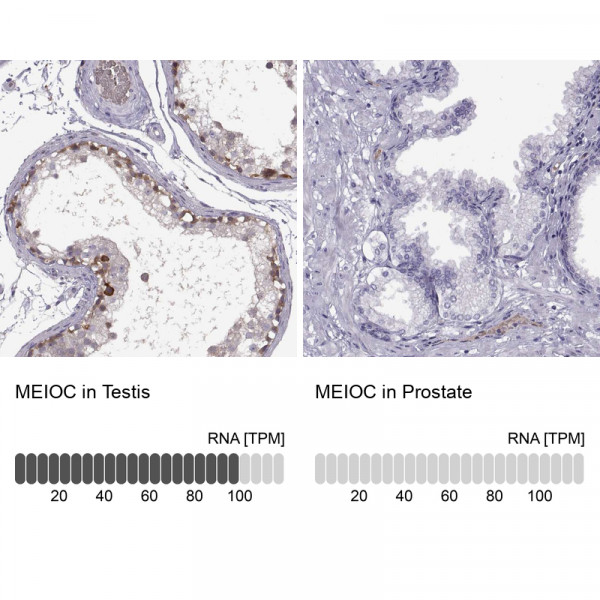 Anti-MEIOC