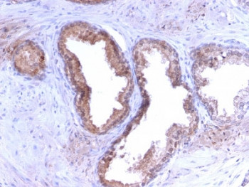 Anti-PSA / Prostate Specific Antigen, clone KLK3/2871R