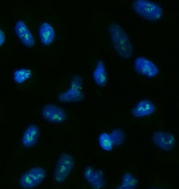 Anti-TOX2 / GCX-1