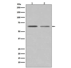Anti-Estrogen Receptor alpha, clone IE-5