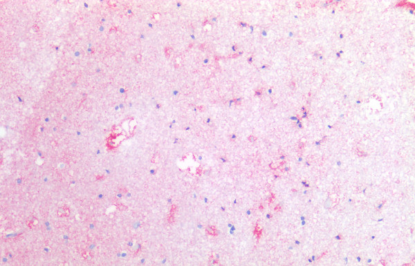 Anti-Tissue Factor, clone HTF-1