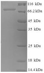 Nuclear RNA export factor 3 (NXF3), human, recombinant