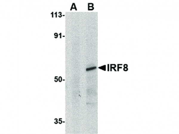 Anti-IRF8