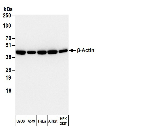 Anti-Rabbit IgG-heavy and light chain cross-adsorbed, HRP conjugated