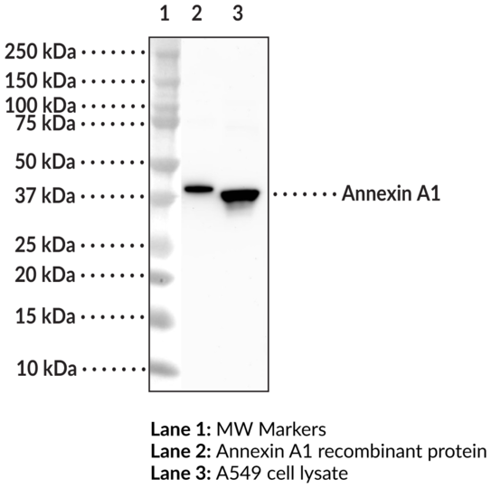 Anti-Annexin A1