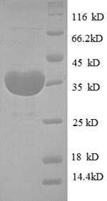 Cystatin-B (CSTB), human, recombinant