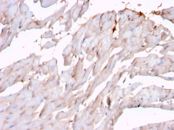 Anti-N-Cadherin / Cadherin-2 / CD325 (NCAD), recombinant antibody, clone rCDH2/1426