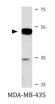 Anti-NHERF1 / EBP50