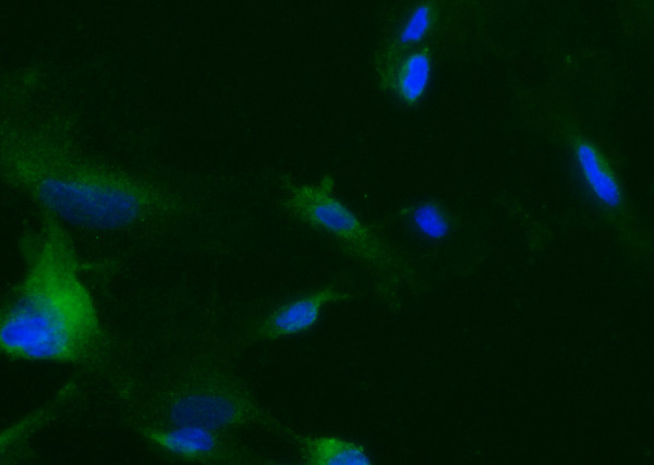 Anti-Tie2/CD202b/TEK Monoclonal Recombinant Antibody