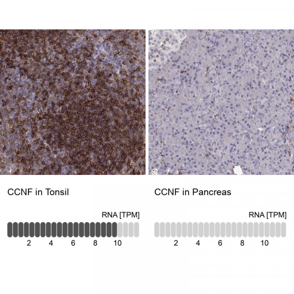 Anti-CCNF