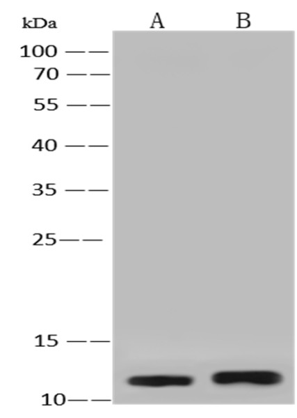 Anti-S100A2 Monoclonal Antibody