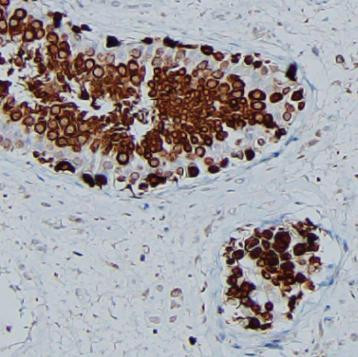 Anti-HSP90AA1