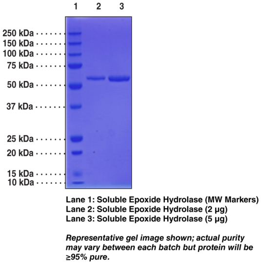 Soluble Epoxide Hydrolase (human, recombinant)