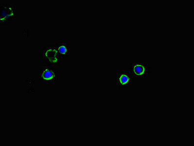Anti-SLC2A2