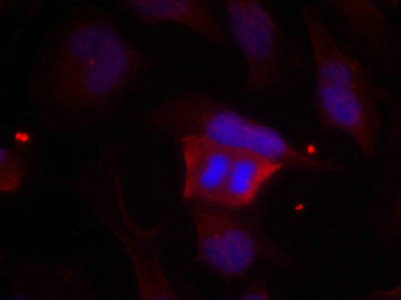 Anti-Phospho-PPP1R1B (Thr75)