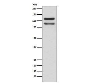 Anti-p120 Catenin / CTNND1 / Catenin delta 1, clone GI-3