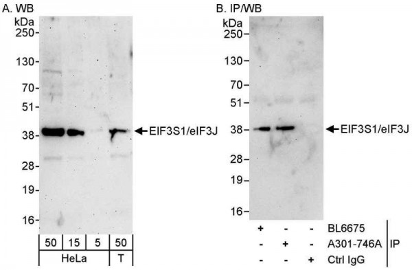 Anti-eIF3J/EIF3S1