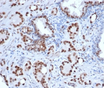 Anti-Androgen Receptor, clone rDHTR/6818