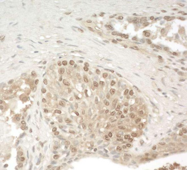 Anti-ZCCHC11 (IHC)