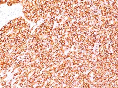 Anti-CD45 / LCA (Leucocyte Marker)(Clone: SPM570)