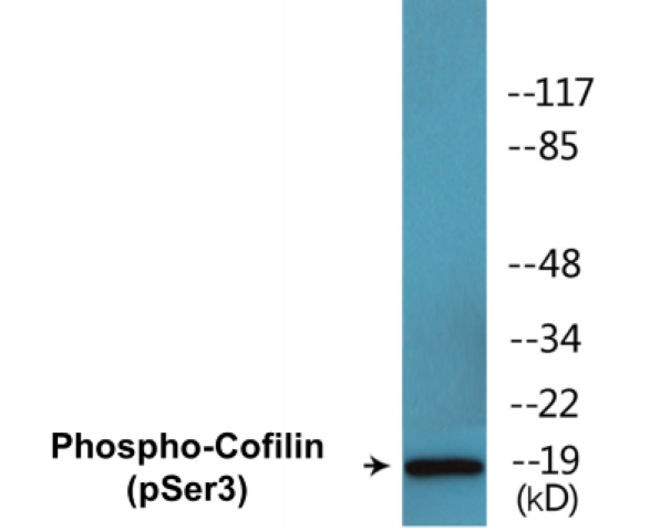 Cofilin (Phospho-Ser3) Colorimetric Cell-Based ELISA Kit