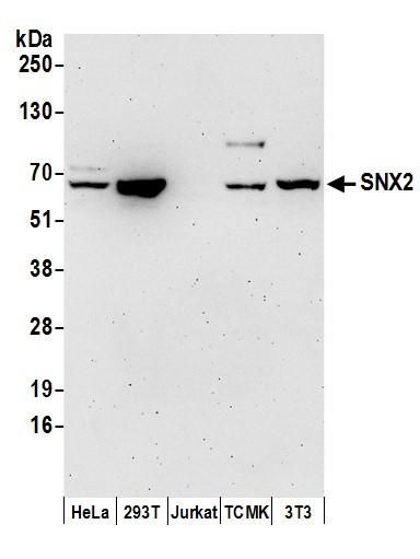 Anti-SNX2