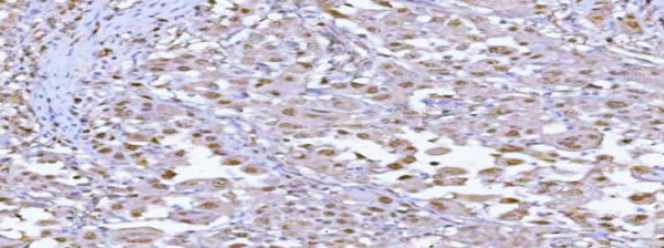 Anti-PSMA1