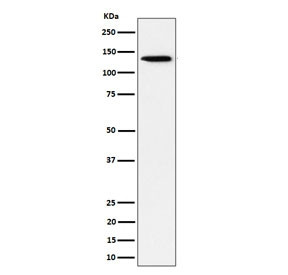 Anti-TRIM24 / TIF1 alpha (recombinant antibody), clone 29T46