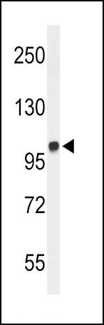 Anti-MICAL2, NT (MICAL2, KIAA0750, MICAL2PV1, MICAL2PV2, Protein-methionine sulfoxide oxidase MICAL2