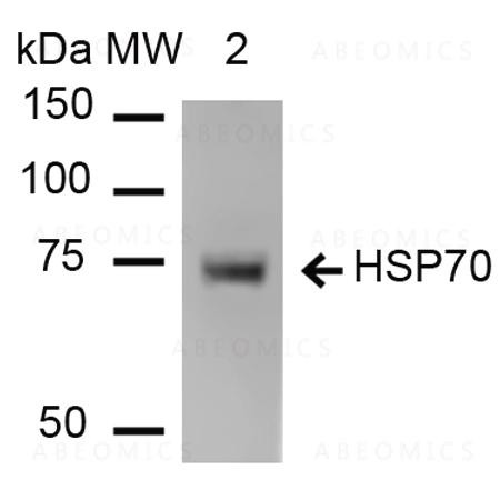 Anti-HSP70 Monoclonal Antibody (Clone: 1H11) - Alkaline Phosphatase