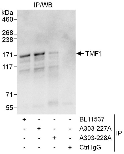 Anti-TMF1