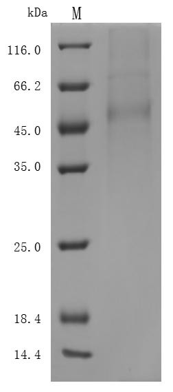 Delta-like protein 3 (DLL3), partial (Active), human, recombinant