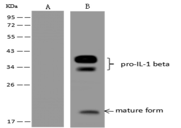 Anti-IL-1 beta Monoclonal Antibody