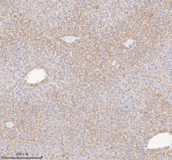 Anti-Hydroxyacid oxidase 1 / HAO1