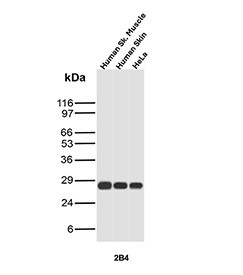 Anti-HSP27 / HSPB1, clone r2B4