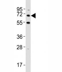 Anti-p62