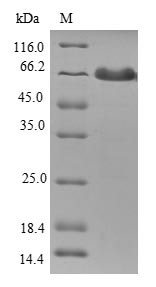 Tropomodulin-1 (TMOD1), human, recombinant