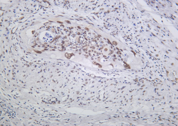 Anti-Recombinant MRE11, clone 6B9