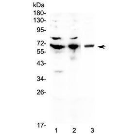 Anti-CD5