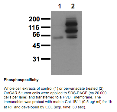 Anti-phospho-beta-Catenin (Tyr654) / gamma-Catenin (Tyr643), clone 1B11