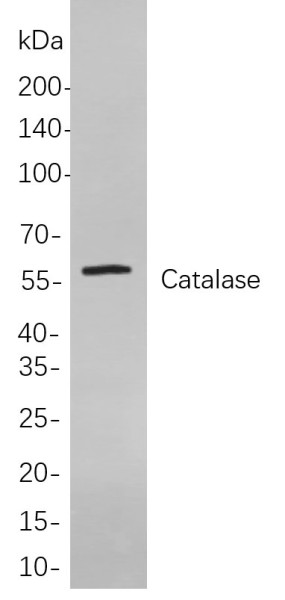 Anti-Recombinant Catalase, clone 6G9