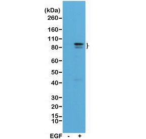 Anti-phospho-STAT3 (Tyr705), clone RM261 (recombinant antibody)