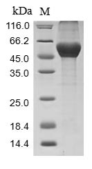 Serine protease inhibitor A3N (Serpina3n), mouse, recombinant