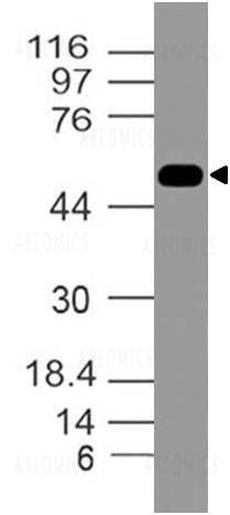 Anti-DR4 (Clone: ABM1B11 )