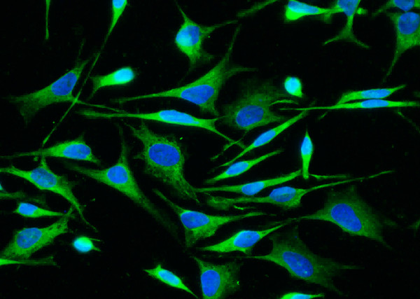 Anti-ALDH7A1 Monoclonal Recombinant Antibody